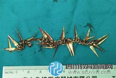 兒童誤食的金屬鏈，長(zhǎng)約9厘米。北京兒童醫(yī)院供圖