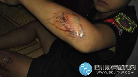 夏令營亂象：“西點軍?！笔軅麩o人問 退款無門