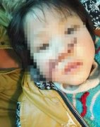 看動畫片要注意！10歲女孩模仿光頭強將